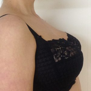 Help! I Have Saggy Breasts! or, Breast Density: It's A Thing